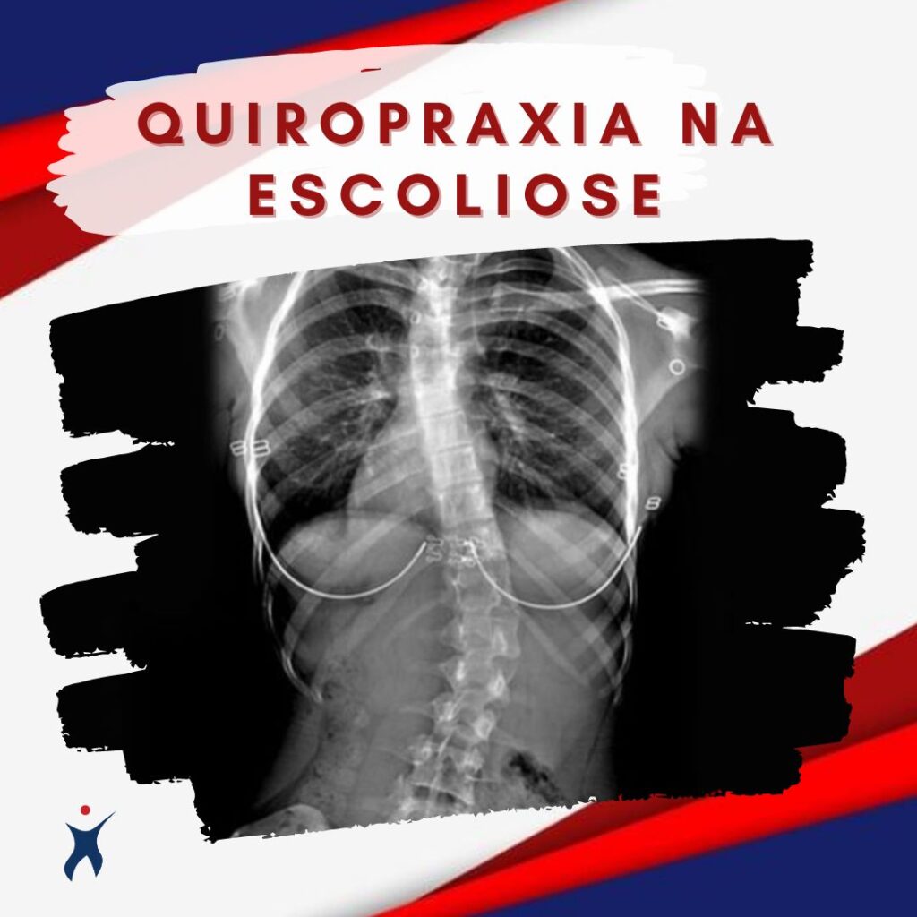 Anatomia da coluna vertebral e a escoliose